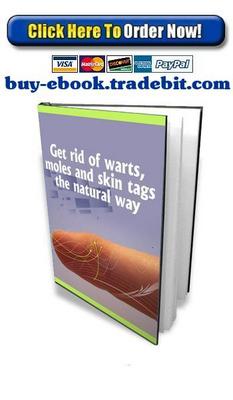 Product picture Get Rid Of Warts